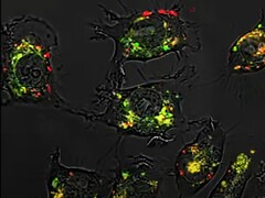 Gracias a los ácidos nucleicos esféricos, el compuesto 5-fluorouracilo fue 20.000 veces más eficaz de lo habitual en los estudios con animales. (Fuente de la imagen: Universidad Northwestern)