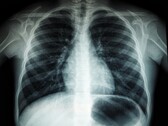 Imagen de rayos X de un torso humano (Fuente de la imagen: Umanoide vía Unsplash; recortada)