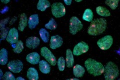 Una imagen que muestra células madre obtenidas de la piel de una mujer (Fuente de la imagen: UCLA vía CIRM)