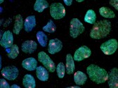 Una imagen que muestra células madre obtenidas de la piel de una mujer (Fuente de la imagen: UCLA vía CIRM)