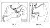 Una patente de Fitbit muestra detalles de un posible monitor de presión arterial para el dedo. (Fuente de la imagen: USPTO)