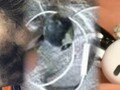 La explosión mortal de unos auriculares es el último fallo impactante de un aparato de audio personal. (Fuente de la imagen: Neowin/Times of India/WFLA - editado)