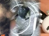 La explosión mortal de unos auriculares es el último fallo impactante de un aparato de audio personal. (Fuente de la imagen: Neowin/Times of India/WFLA - editado)