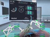 La interfaz de STELLAR Knee mostrando las dimensiones y posiciones calculadas de los huesos de la pierna durante la cirugía de rodilla. (Fuente: PolarisAR en Youtube)