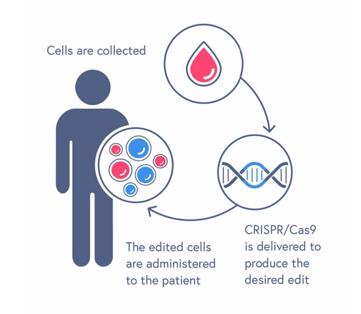 El proceso de tratamiento CASGEVY implica la transfusión de células madre sanguíneas editadas. (Fuente: CRISPR Therapeutics)