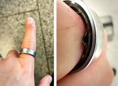 Un Samsung Galaxy Ring con la batería hinchada obligó a un usuario a acudir al hospital. (Fuente de la imagen: Zone of Tech)