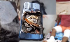 El Oppo A53 supuestamente explotó, dejando a su propietario con heridas en ambas piernas. (Fuente de la imagen: Technical Dost - editado)