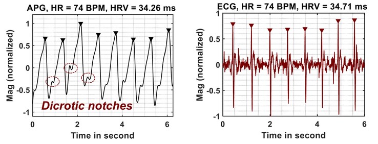 Las lecturas de APG se comparan favorablemente con las del ECG (Fuente de la imagen: Google Research)