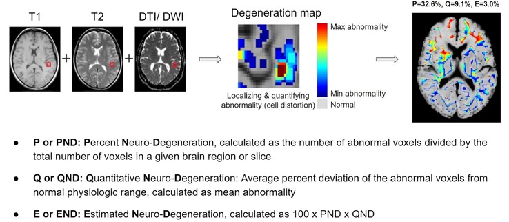 BrainSee puede detectar zonas anómalas del cerebro a partir de una resonancia magnética y dar a los médicos una puntuación que indica la probabilidad de que un paciente desarrolle Alzheimer. (Fuente: Darmiyan)