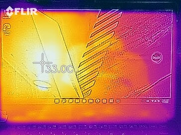 Mapa de calor - En reposo (frente)