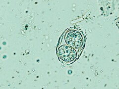 Toxoplasma gondii mostrado aquí en su forma de huevo infeccioso. (Fuente de la imagen: Todorean Gabriel/iStock/Getty Images Plus)