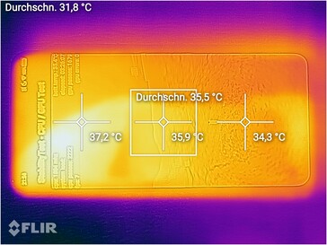 Distribución del calor (frente)
