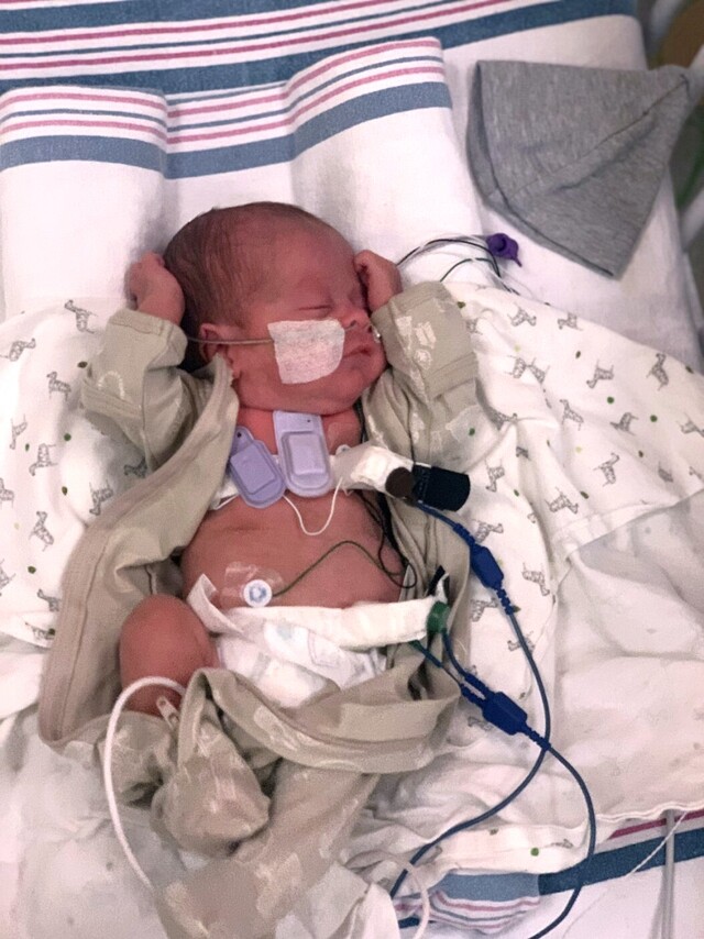 Sensor de sonido de la NWU en un bebé prematuro para controlar la función pulmonar. (Fuente: Universidad Northwestern)