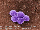 Integrated Biosciences descubre una nueva clase de antibióticos eficaces contra la bacteria MRSA resistente. (Fuente: Biblioteca de imágenes de salud pública nº 9994)