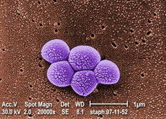 Integrated Biosciences descubre una nueva clase de antibióticos eficaces contra la bacteria MRSA resistente. (Fuente: Biblioteca de imágenes de salud pública nº 9994)