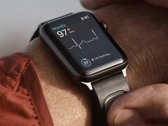 La KardiaBand es una banda de monitorización de ECG diseñada para el Apple Watch. (Fuente de la imagen: Kardia)