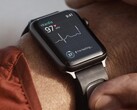 La KardiaBand es una banda de monitorización de ECG diseñada para el Apple Watch. (Fuente de la imagen: Kardia)