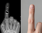 Bone Biologics solicita la patente de una novedosa tecnología de regeneración ósea (Fuente de la imagen: imagen ilustrativa generada por IA)