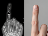 Bone Biologics solicita la patente de una novedosa tecnología de regeneración ósea (Fuente de la imagen: imagen ilustrativa generada por IA)