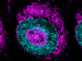 Una célula cancerosa confinada (en la imagen) - se pueden ver las mitocondrias de color magenta acumulándose en la periferia nuclear de color cian y dentro de las hendiduras nucleares. (Fuente de la imagen/capítulo: Rito Ghose y Fabio Pezzano/Centro de Regulación Genómica)