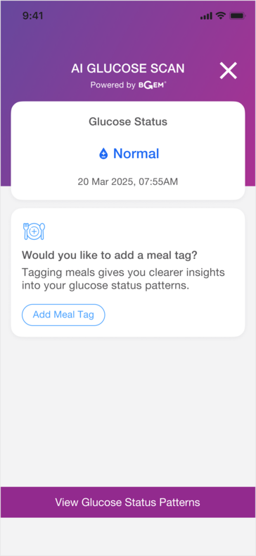 El anillo inteligente podría ser útil para descubrir vínculos entre determinados alimentos y el nivel de azúcar en sangre del usuario