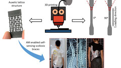 Ortesis de espalda adaptable impresa en 3D (imagen: Universidad de Glasgow)