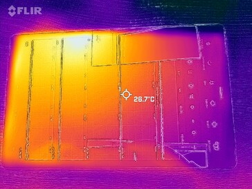 Termografía - frontal