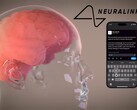 La visión de Neuralink: control total de los dispositivos digitales mediante el pensamiento (Fuente de la imagen: Neuralink)
