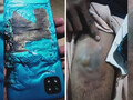 Poco C3 explota. (Fuente: BNNewsTV)