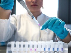 Oxford BioTherapeutics y Roche anuncian una asociación estratégica para terapias contra el cáncer (Fuente de la imagen: Julia Koblitz, Unsplash)