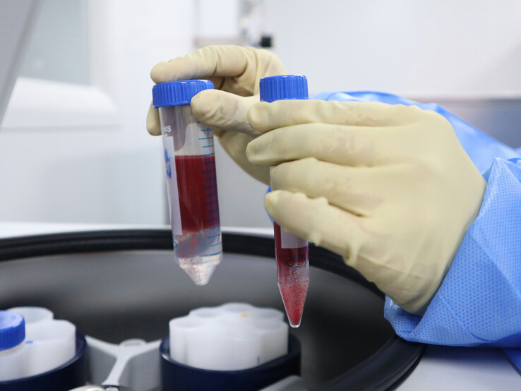 Los laboratorios de análisis de sangre fueron algunos de los servicios del NHS afectados por el ciberataque a la cadena de suministro de Synnovis (Fuente de la imagen: Unsplash/Malcolm Choong)