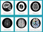 El software de IA médica BrainSee de Darmiyan puede detectar precozmente signos de Alzheimer. (Fuente: Darmiyan)