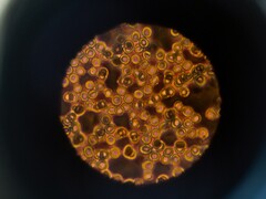 Células sanguíneas al microscopio (Fuente de la imagen: ThisisEngineering via Unsplash; recortada)