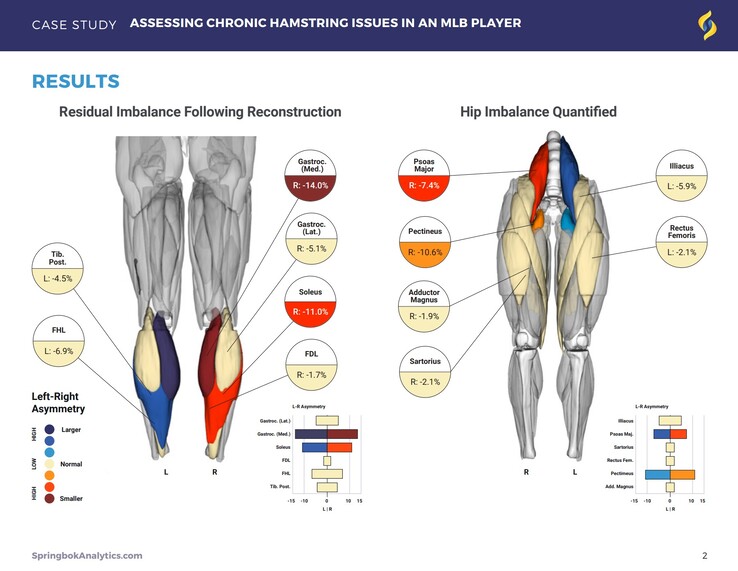 Los informes de Springbok Analytics detallan los músculos individuales a través de resonancias magnéticas en 3D. (Fuente: Springbok Analytics)