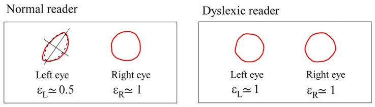 Los centroides de Maxwell difieren en simetría en los sujetos normales, pero son similares en los sujetos disléxicos. (Fuente de la imagen: DOI 10.3390/brainsci13101478) 