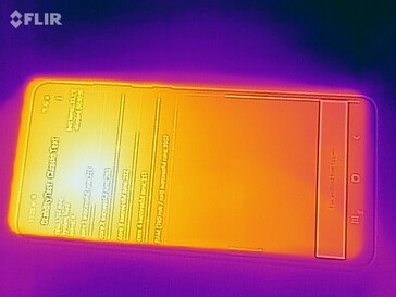 Imagen térmica frontal