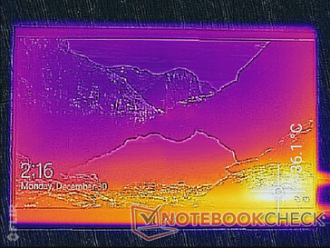 Temperatura de la superficie (frontal)