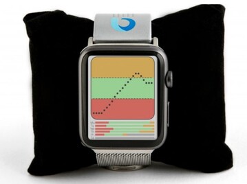 Concepto con el monitor integrado con un Apple Watch. (Fuente de la imagen: Iterate)