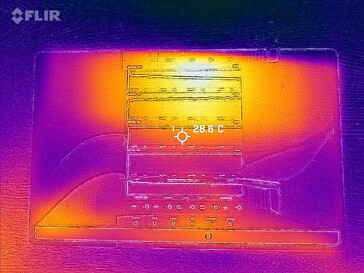 Imagen térmica: frontal