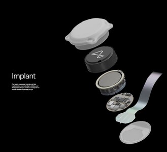 Los distintos componentes del implante Neuralink. (Fuente: Neuralink)